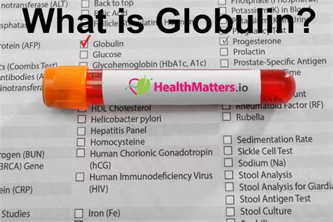 beta 1 globulin low|Globulin Test: High & Low Levels + Normal Range .